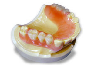 港南台の歯医者、すずき歯科クリニックの入れ歯