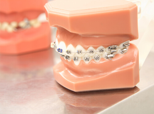 港南台の歯医者、すずき歯科クリニックの矯正歯科