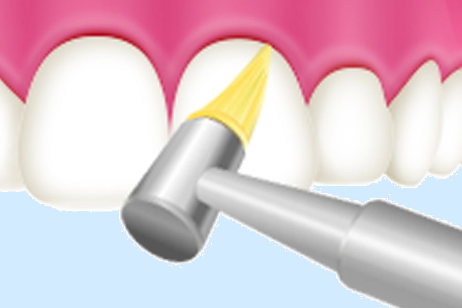 歯と歯の間を掃除