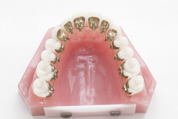 港南台の歯医者、すずき歯科クリニックの舌側矯正